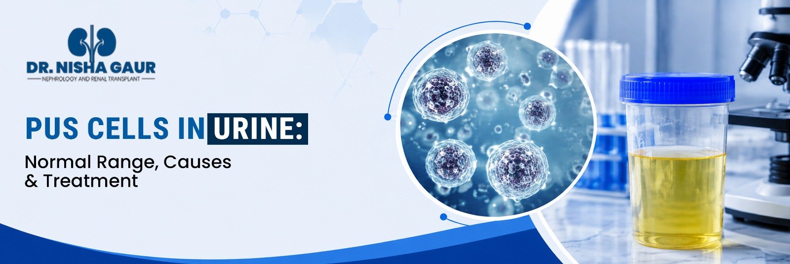 Pus Cells in Urine